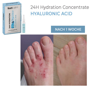 Feetcalm 24H Hydration Concentrate 7x2 ml